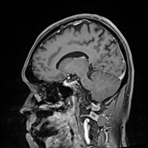 Click on the Serie image to view the images of VILLANUEVA, WILLIAM A.